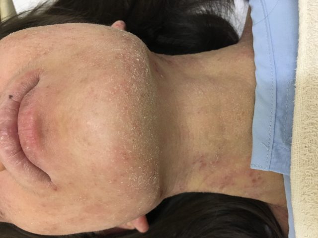 before画像